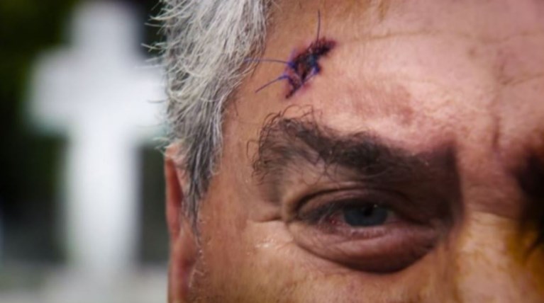 ΠΥΡΟΒΟΛΙΣΜΟΣ ΝΕΚΡΟΤΑΦΕΙΟ