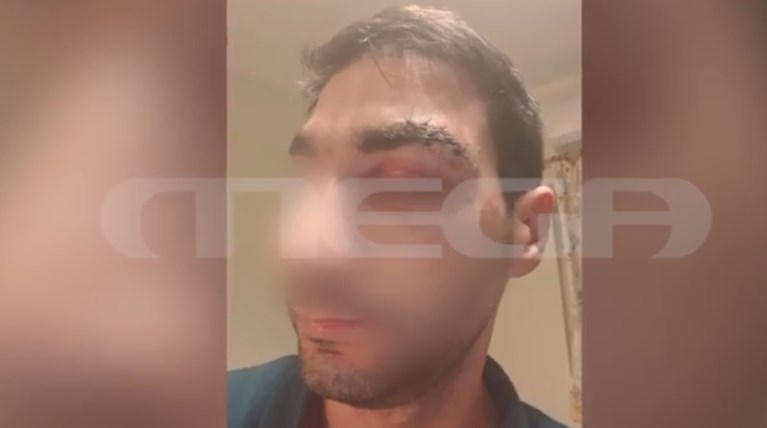 ΑΙΓΙΟ ΓΙΑΤΡΟΣ