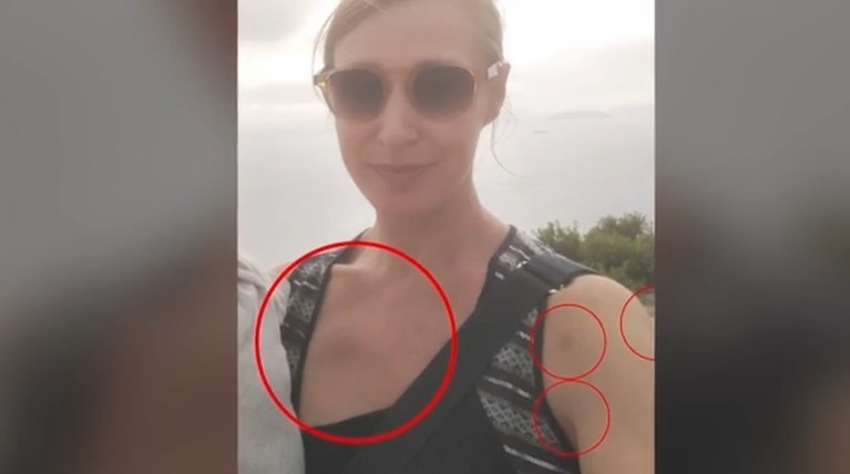 40ΧΡΟΝΗ ΚΟΡΩΠΙ