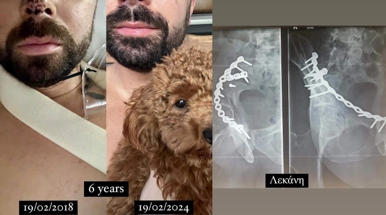 Ηλίας Βρεττός τροχαίο