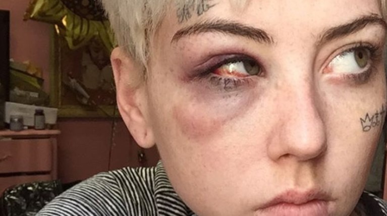 Επίθεση στη ζωγράφο που σκιτσάρισε το πέος του Τραμπ