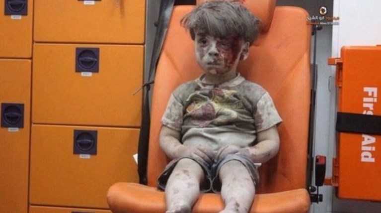 «Έφυγε» ο αδελφός του 5χρονου Ομράν που συγκλόνισε τον κόσμο