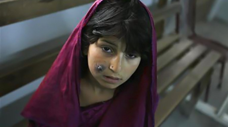 To κρυφό βιολογικό όπλο των τζιχαντιστών. Φωτογραφίες-σοκ