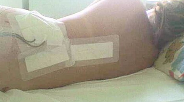 H συγκλονιστική εξομολόγηση μιας ελληνίδας για τη μάχη με τον καρκίνο