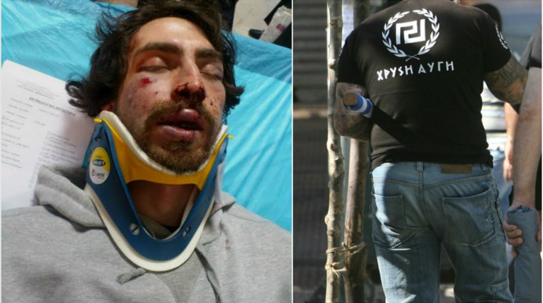 Φονική επίθεση χρυσαυγιτών νεοναζί σε φοιτητή (σκληρές φωτό)
