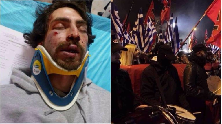 Ποινική δίωξη στον μετακλητό της ΧΑ για την επίθεση στον φοιτητή