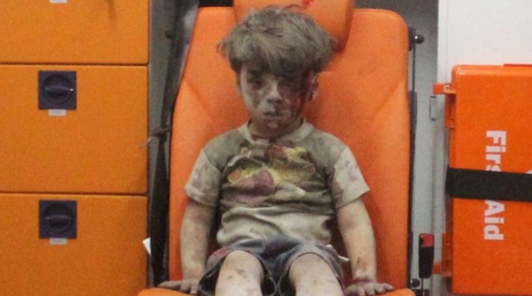 Ομράν: Το παιδί -  σύμβολο του πολέμου, ένα χρόνο μετά