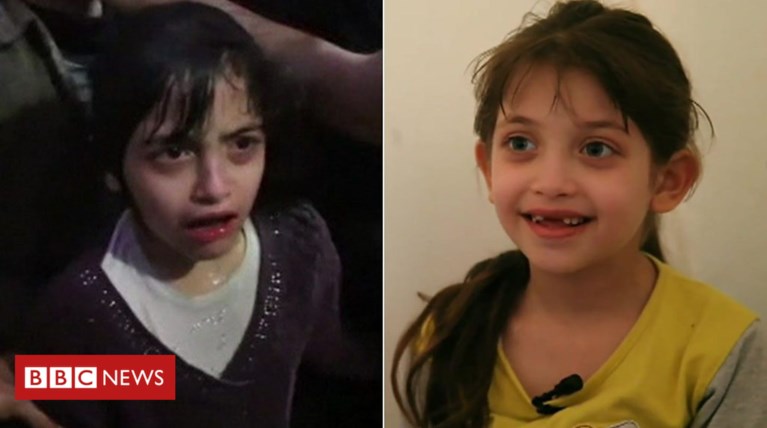 Η μικρή Μάσα για την επίθεση με χημικά: «Αναπνέαμε την οσμή του αίματος»