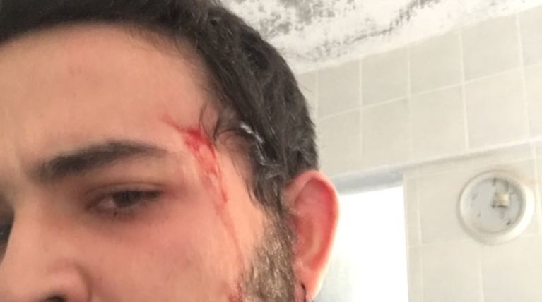 Βουλευτής του Ερντογάν έδειρε μέλη του φιλοκουρδικού κόμματος HDP