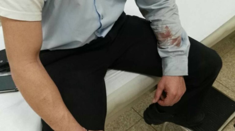 Τραυματίστηκαν αστυνομικοί μετά από επίθεση με μάρμαρα [εικόνες]