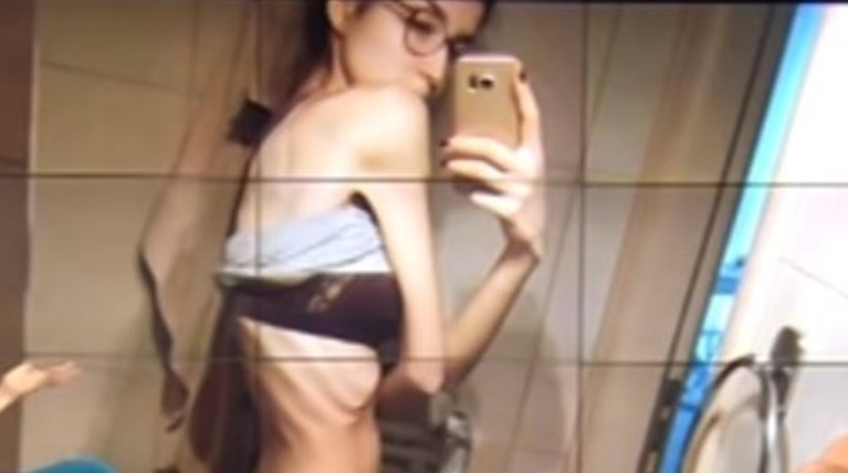 Πρώην παίκτρια GNTM: Έφτασα να ζυγίζω 37 κιλά, αλλά να με βλέπω χοντρή