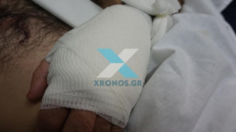 Σοκάρουν οι εικόνες του μαχαιρωμένου αστυνομικού στη Ροδόπη