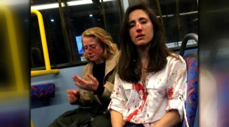 Βίντεο-σοκ από τον ξυλοδαρμό δύο γυναικών στο Λονδίνο