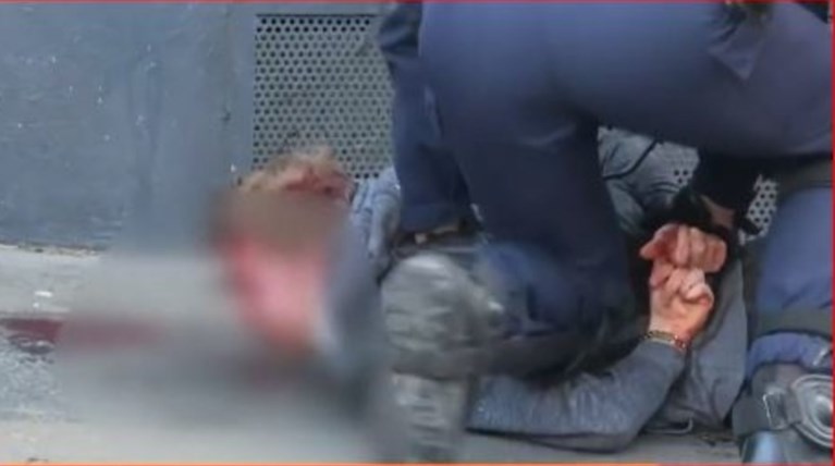 Οργή στη Γαλλία για τον ξυλοδαρμό διαδηλωτή- Ηταν πεσμένος και αιμόφυρτος