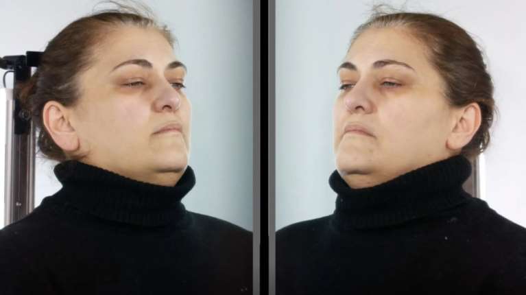 Αττική: Δημοσιοποιήθηκαν τα στοιχεία της 45χρονης που παρίστανε την οικιακή βοηθό και έκλεβε ΑμεΑ