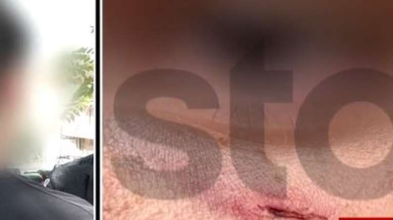 Άγριο ξύλο σε 14χρονο σε Γυμνάσιο για μια λάθος πάσα στο μπάσκετ: Οι ίδιοι είχαν επιτεθεί και στον αδερφό του