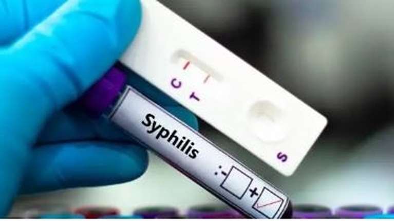 Δραματική η αύξηση σύφιλης κατά 65% στην Ελλάδα κατά την πανδημία - Ποια είναι τα ύποπτα συμπτώματα