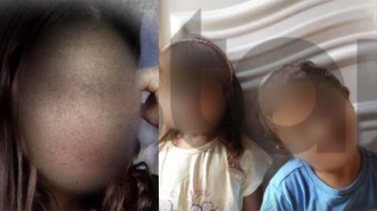 Λάρισα:  Οι γείτονες έβλεπαν ψαλίδια στο κρεβάτι των παιδιών, ήταν με ξυρισμένη τη μία πλευρά των μαλλιών τους και σκισμένα ρούχα