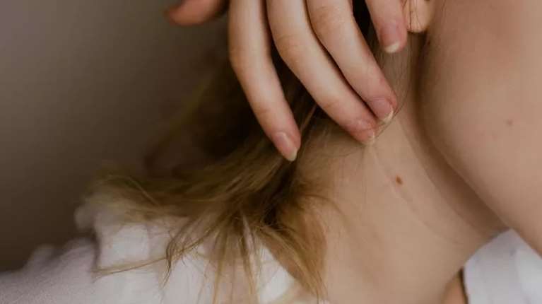 Πώς να ξεχωρίσεις μια επικίνδυνη ελιά - Οι 6 αλλαγές που στέλνουν "SOS"