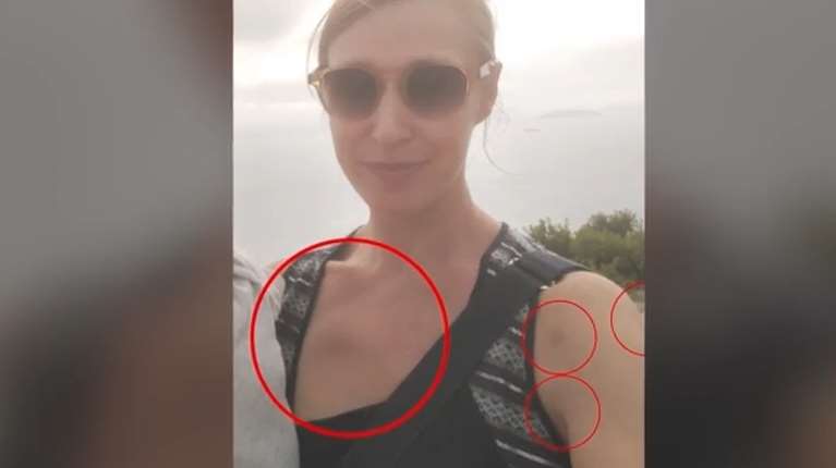 Κορωπί:  Ήθελε τα παιδιά να έχουν πατέρα, λέει η μητέρα της 40χρονης που ξυλοκοπήθηκε άγρια από τον σύντροφό της