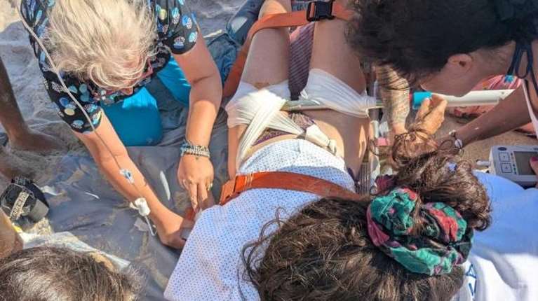 Ατύχημα σοκ στη Δονούσα: Ομπρέλα καρφώθηκε στο πόδι τουρίστριας - Χωρίς τραυματιοφορέα και πλωτό ασθενοφόρο το νησί