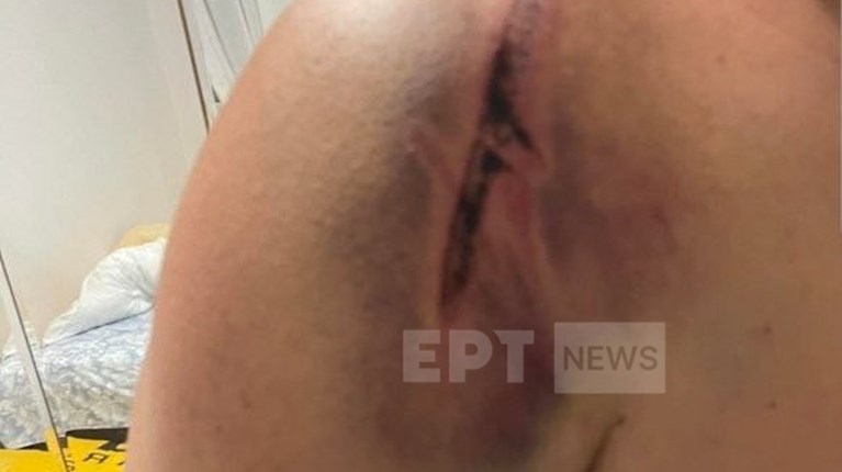 ΞΥΛΟΔΑΡΜΟΣ ΘΕΣΣΑΛΟΝΙΚΗ