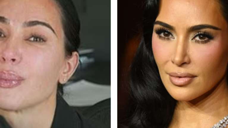 Η Κιμ Καρντάσιαν διαγνώστηκε με ανεύρυσμα στον εγκέφαλο - Το αποκάλυψε με δάκρυα στα μάτια