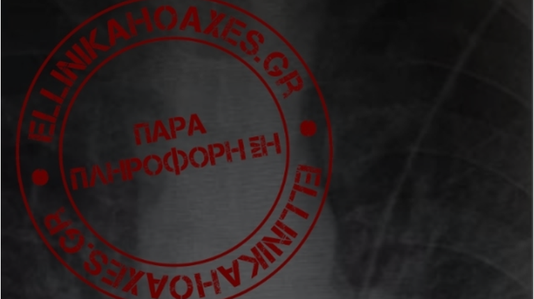 Ακτινογραφία Hoaxes