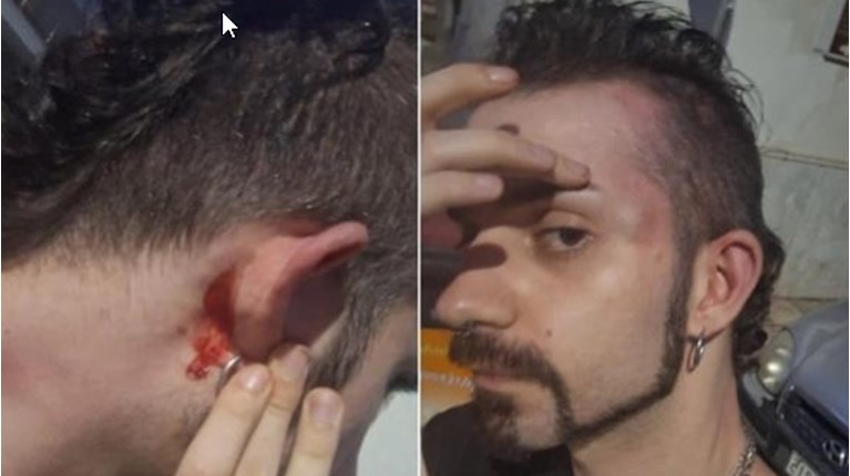 ΟΜΟΦΟΒΙΚΗ ΕΠΙΘΕΣΗ