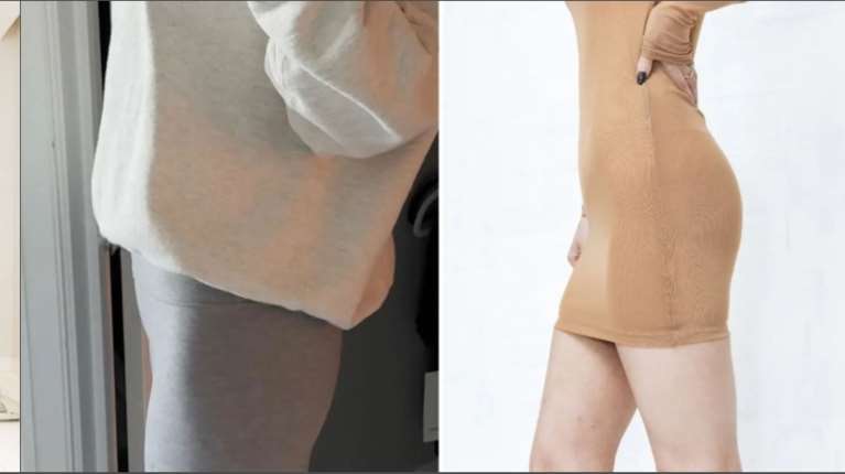 ΗΠΑ: Χάνουν βάρος με Ozempic και μετά φτιάχνουν γλουτούς με ενέσεις λίπους από πτώματα - Για το τέλειο σώμα