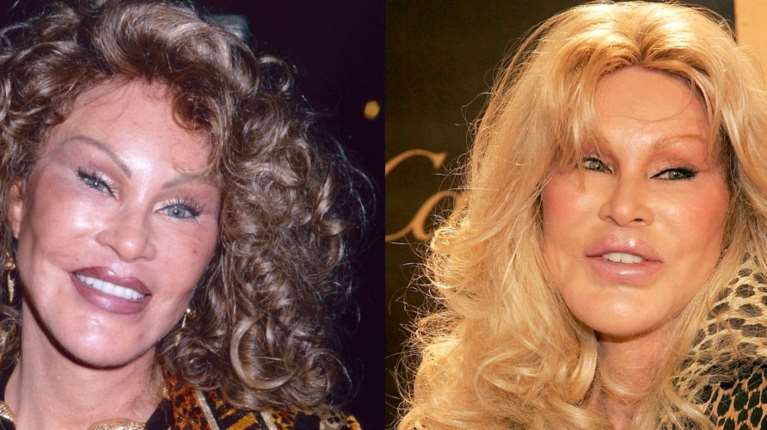 Πέθανε η εκκεντρική Ελβετή Catwoman: Οι αλλεπάλληλες πλαστικές επειδή ο δισεκατομμυριούχος σύζυγος την ήθελε να μοιάζει με γάτα