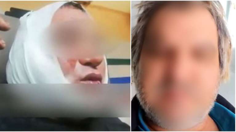 Κορωπί: Σοκάρει το παρελθόν του δράστη με το κατσαβίδι: Του είχαν κόψει το αυτί σε καβγά σε λαϊκή αγορά