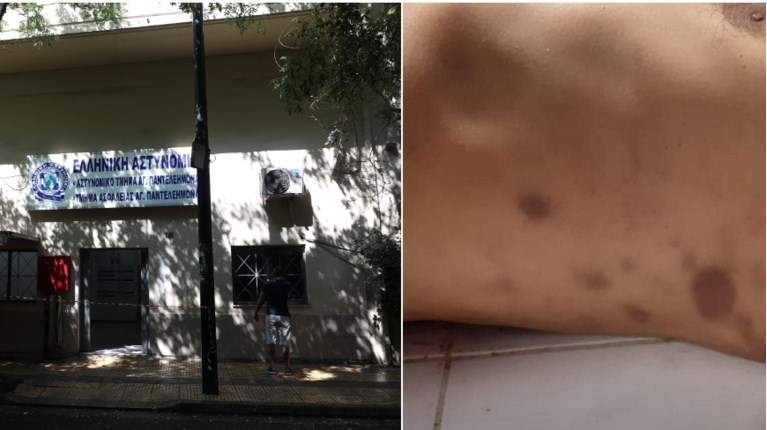 ΜΕΤΑΝΑΣΤΗΣ ΑΓΙΟΣ
