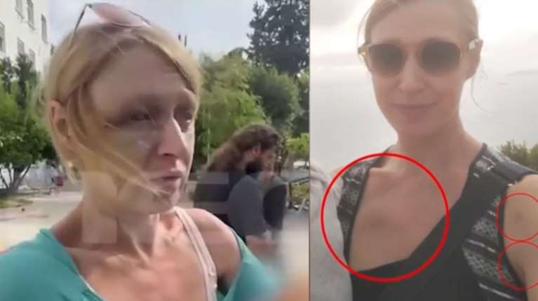 Κορωπί: &quot;Δεν θυμάμαι τι έγινε&quot; επιμένει η 40χρονη - &quot;Έχει αμνησία, είναι σε σοκ&quot; λέει ο πατέρας της [βίντεο]