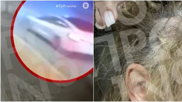 επιθεση 43χρονη πλαστικοσ