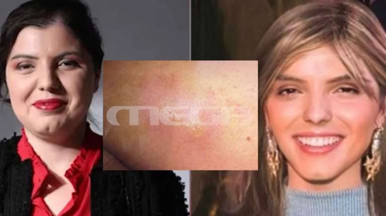 Μαρίσσα Λαιμού: Τα μηνύματα σε φίλη της μέσα από το νοσοκομείο - "Είμαι χάλια, κανείς δεν με έχει τσεκάρει"