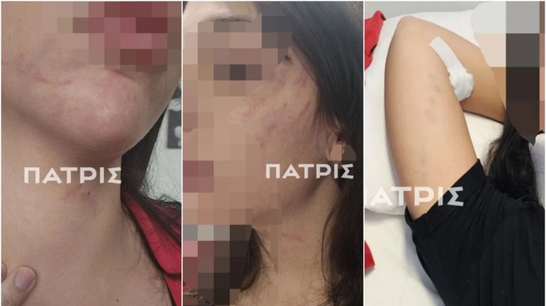 ΚΑΚΟΠΟΙΗΣΗ ΕΔΕΣΣΑ