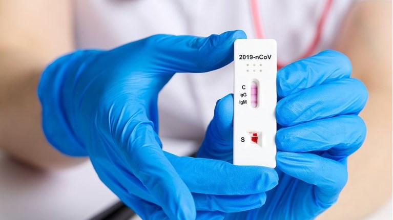 RAPID TEST