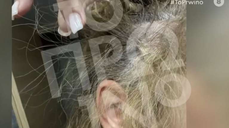 Γνωστός πλαστικός χειρουργός ξυλοκόπησε 43χρονη οδηγό στη Συγγρού - Την άρπαξε από τα μαλλιά και τη χτυπούσε [βίντεο]