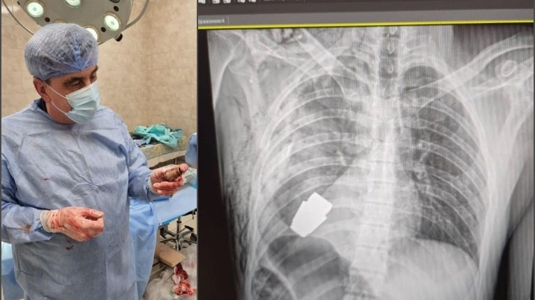 ΟΥΡΚΑΝΙΑ ΧΕΙΡΟΒΟΜΒΙΔΑ