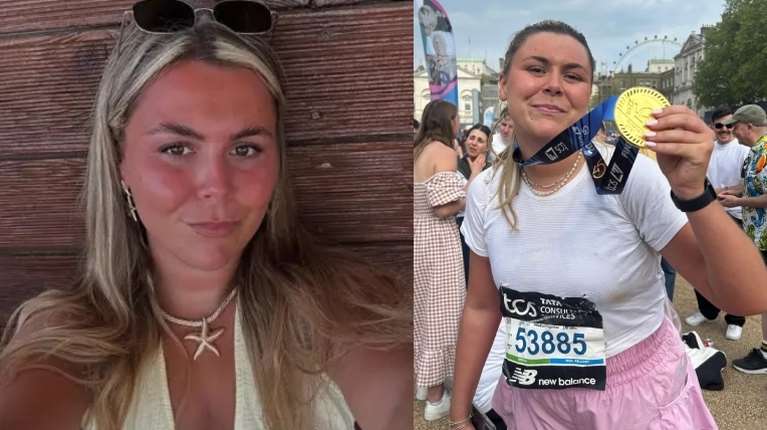 Τραγικό τέλος για 24χρονη Ουαλή μετά τις διακοπές στην Ελλάδα: Τα συμπτώματα αλλεργίας και η διάγνωση που δεν έγινε