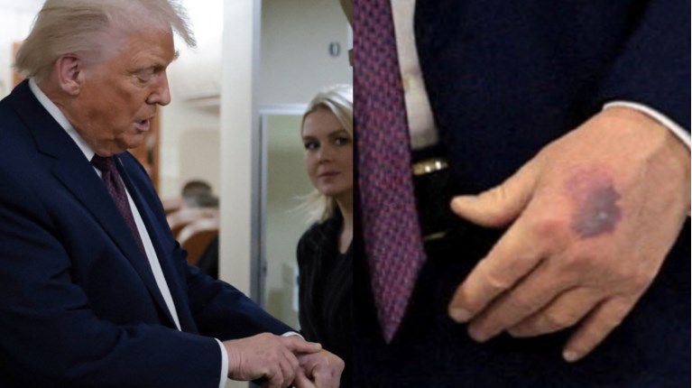 τραμπ μελανια