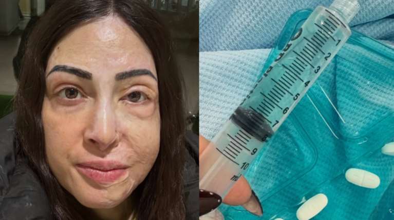 Ιωάννα Παλιοσπύρου: Βίντεο από την αποκατάσταση μετά την επίθεση με βιτριόλι - "Δεν ξέρω πώς αντέχω"