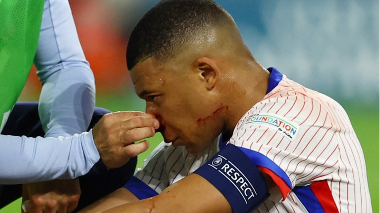 mbappe