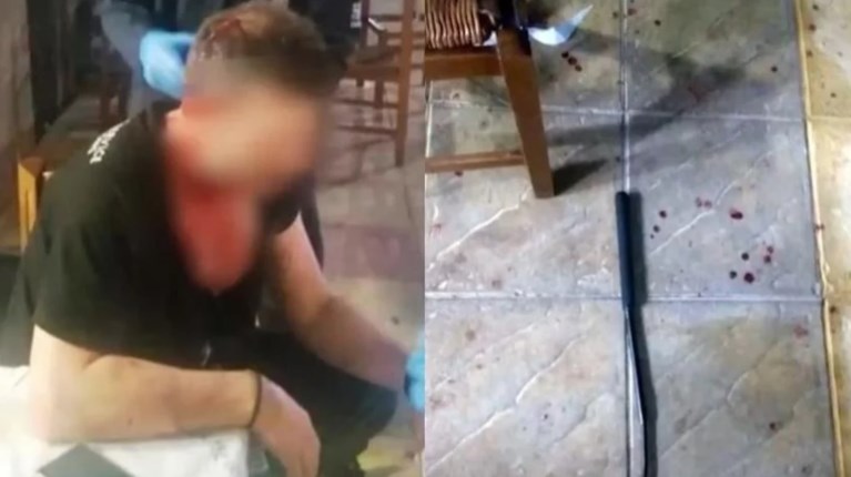 Ξυλοδαρμός Αγρίνιο