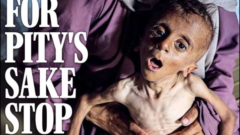 Γάζα: Γροθιά στο στομάχι το εξώφυλλο της &quot;Daily Express&quot; με σκελετωμένο μωρό -  &quot;Για όνομα του Θεού, σταματήστε το τώρα&quot;