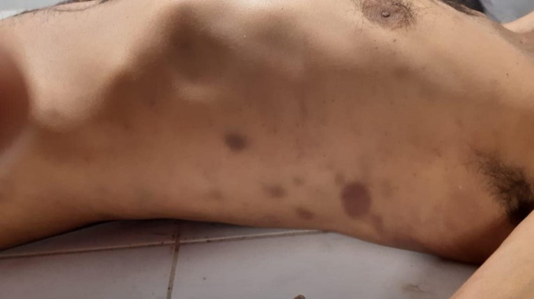 ΑΤ Αγίου Παντελεήμονα μετανάστης