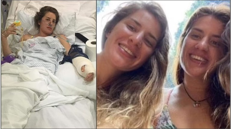 Βρετανίδα πάλεψε με κροκόδειλο και έσωσε τη δίδυμη αδελφή της
