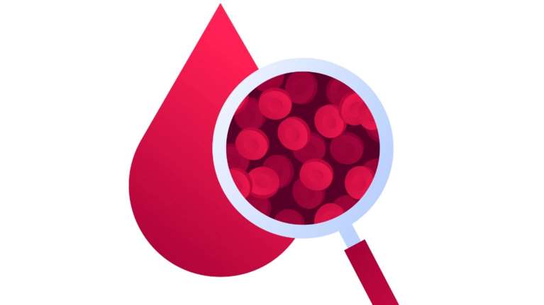 Χαμηλός αιματοκρίτης, έλλειψη βιταμινών; Τι σημαίνουν τα αποτελέσματα από τις εξετάσεις αίματος