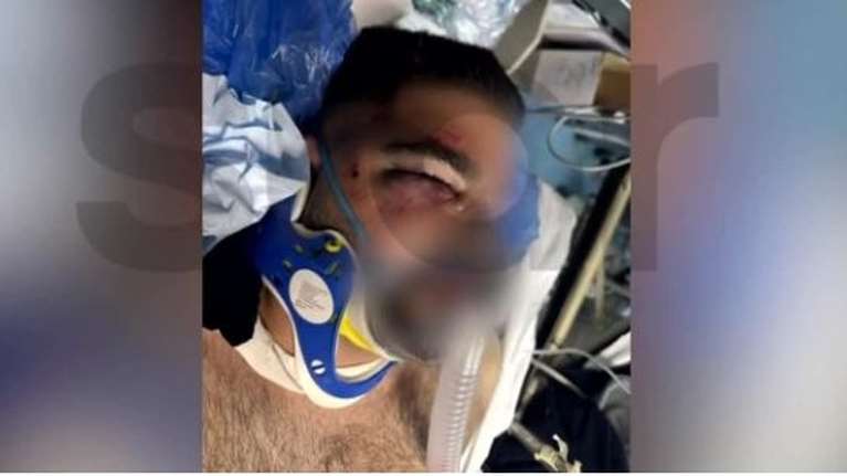 Κηφισιά: Αστυνομική βία κατά του γιου του καταγγέλλει ο πατέρας 20χρονου διασώστη - &quot;Τον χτυπούσε, ενώ φορούσε χειροπέδες&quot;